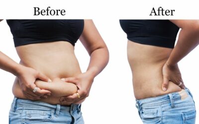 How Long Does it Take to Lose Weight?