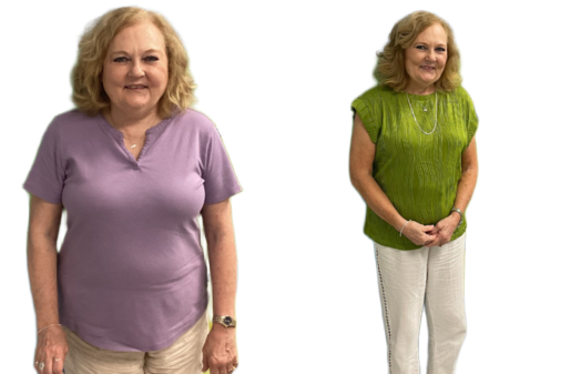 Wilmington Weight Loss Gallery | Wilmington Weight Loss