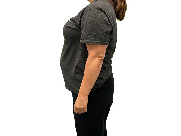 Wilmington Weight Loss Center | Wilmington, NC Wilmington Weight Loss Center | Wilmington, NC