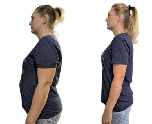 Wilmington Weight Loss Gallery | Wilmington Weight Loss