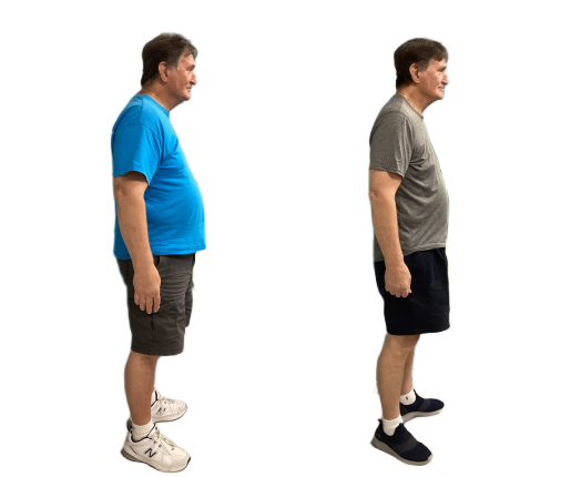 Wilmington Weight Loss Gallery | Wilmington Weight Loss