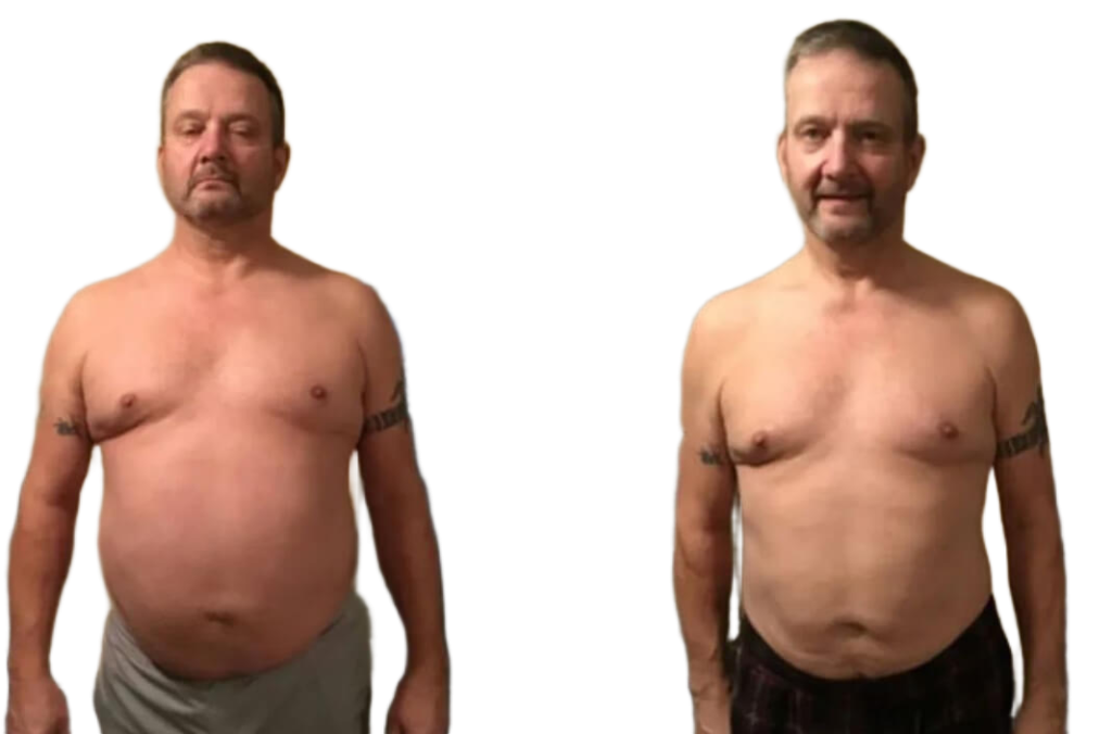 Wilmington Weight Loss Gallery | Wilmington Weight Loss